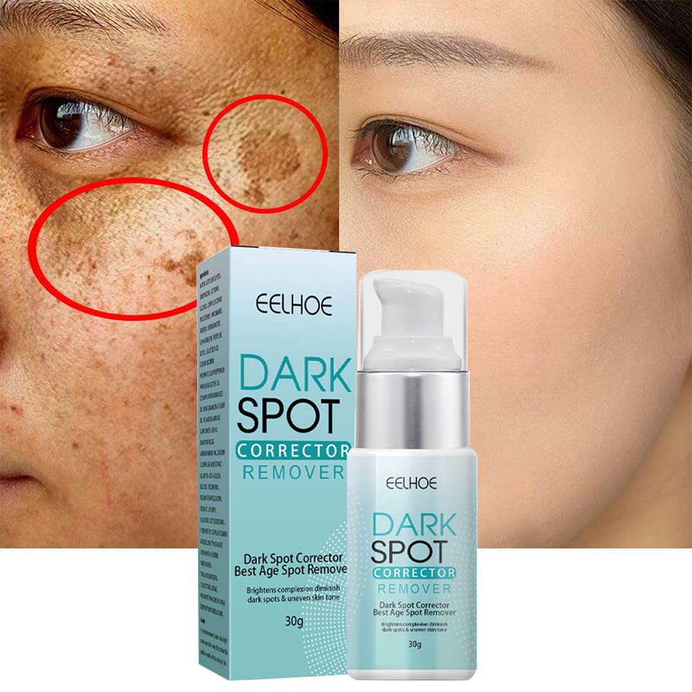 Anti-Dark Spot Skin Care Lightens Pigmentation Spots