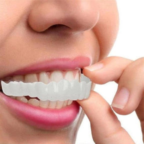 Smile Veneer (Superior e Inferior Inclusos)
