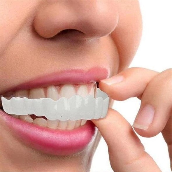 Smile Veneer (Superior e Inferior Inclusos)