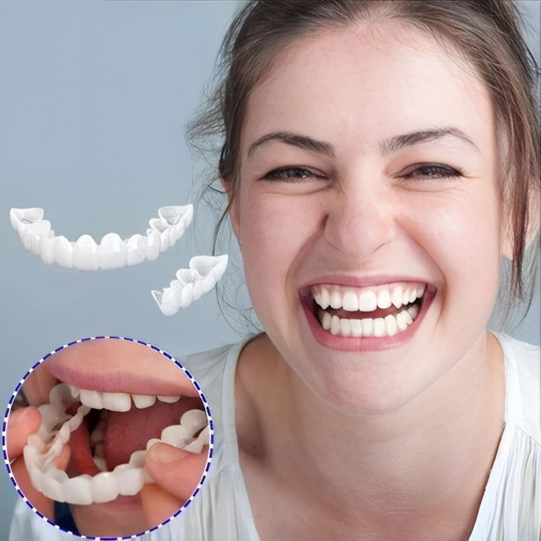 Smile Veneer (Superior e Inferior Inclusos)