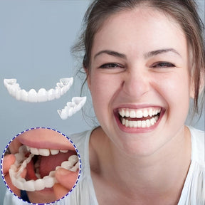 Smile Veneer (Superior e Inferior Inclusos)