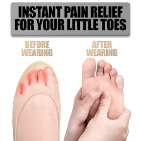 Silicone Anti-Friction Toe Protectors