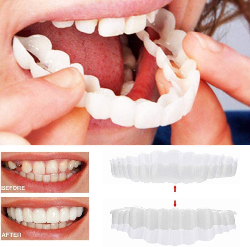 Smile Veneer (Superior e Inferior Inclusos)