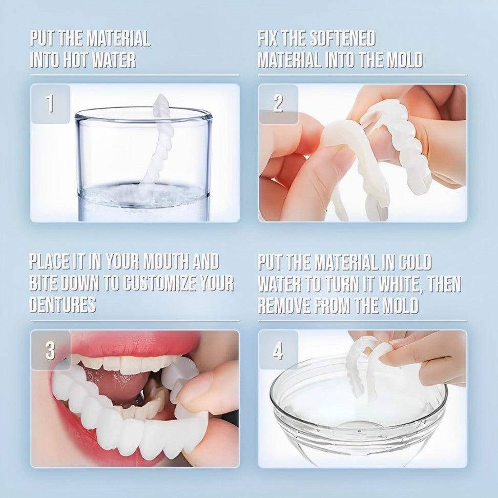 Smile Veneer (Superior e Inferior Inclusos)