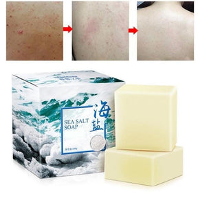 Sabonete de Sal Marinho - Tratamento para Acne
