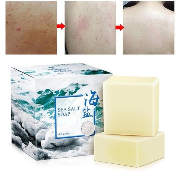 Sabonete de Sal Marinho - Tratamento para Acne