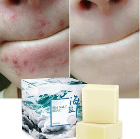 Sabonete de Sal Marinho - Tratamento para Acne