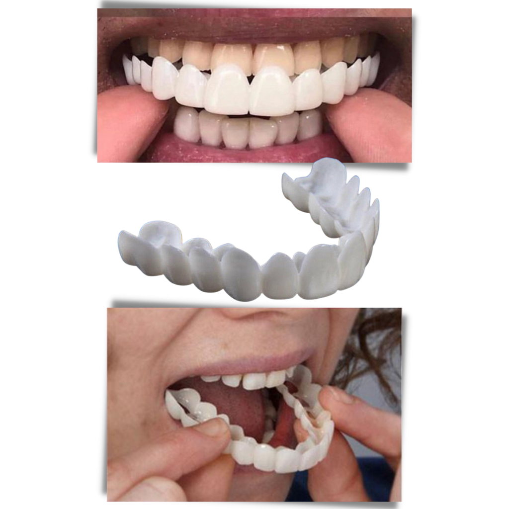 Dental coverage for a perfect smile - comfortable aligners