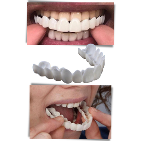 Dental coverage for a perfect smile - comfortable aligners