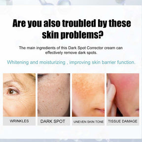 Anti-Dark Spot Skin Care Lightens Pigmentation Spots