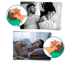 Advanced anti-snoring device