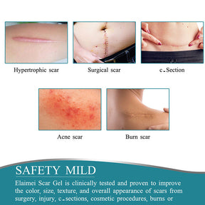 Silicone Scar Tape Roll