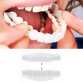 Smile Veneer (Superior e Inferior Inclusos)