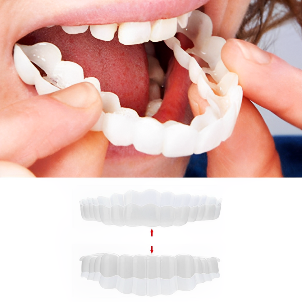 Smile Veneer (Superior e Inferior Inclusos)