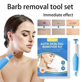 Kit de Remoção de Acrocórdons