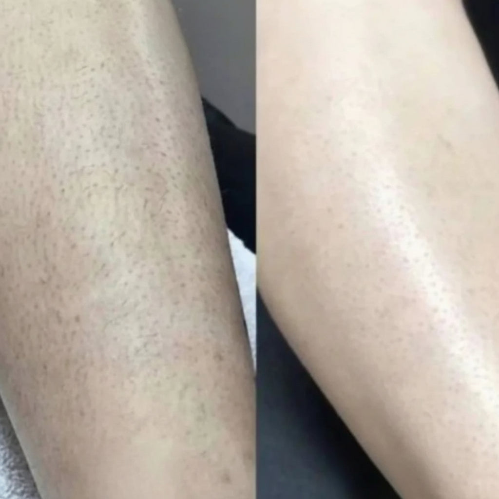 Depilador Elétrico Feminino à Prova D'água para Pele Sensível e Linha do Biquíni