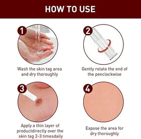 Tags & Moles Remover
