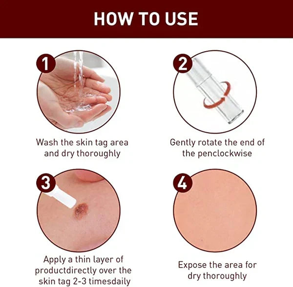 Tags & Moles Remover