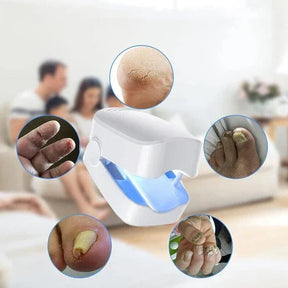 Dispositivo a Laser para Limpeza de Fungos nas Unhas - Dispositivo de Fototerapia Especialista, Revolucionário e de Alta Eficiência para Doenças nas Unhas dos Pés