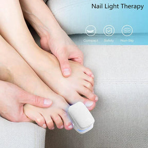 Dispositivo a Laser para Limpeza de Fungos nas Unhas - Dispositivo de Fototerapia Especialista, Revolucionário e de Alta Eficiência para Doenças nas Unhas dos Pés