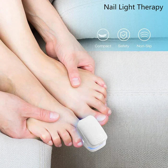 Dispositivo a Laser para Limpeza de Fungos nas Unhas - Dispositivo de Fototerapia Especialista, Revolucionário e de Alta Eficiência para Doenças nas Unhas dos Pés