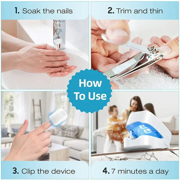 Dispositivo a Laser para Limpeza de Fungos nas Unhas - Dispositivo de Fototerapia Especialista, Revolucionário e de Alta Eficiência para Doenças nas Unhas dos Pés